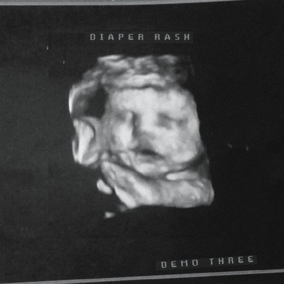 diaperrashdemo3